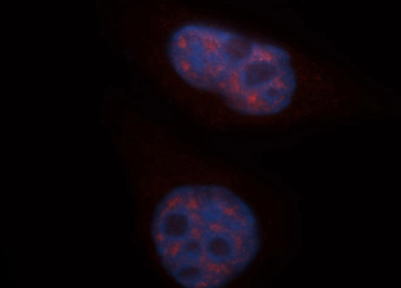 Immunofluorescent analysis of HepG2 cells, using CBLB antibody Catalog No:108899 at 1:50 dilution and Rhodamine-labeled goat anti-rabbit IgG (red). Blue pseudocolor = DAPI (fluorescent DNA dye).
