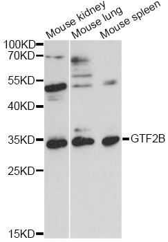 Western blot - GTF2B Polyclonal Antibody 