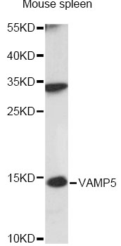 Western blot - VAMP5 Polyclonal Antibody 