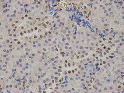 Fig2: Immunohistochemical analysis of paraffin-embedded mouse kidney tissue using anti- ATRX mouse monoclonal antibody.