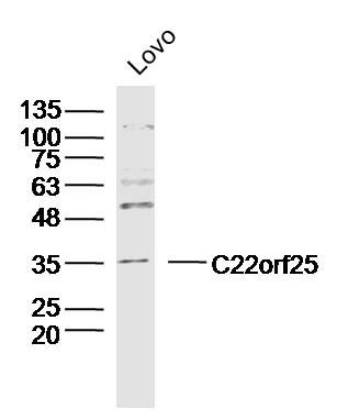 Fig2: Sample:Lovo Cell (Human) Lysate at 30 ug; Primary: Anti- C22orf25 at 1/300 dilution; Secondary: IRDye800CW Goat Anti-Rabbit IgG at 1/20000 dilution; Predicted band size: 31kD; Observed band size: 35kD