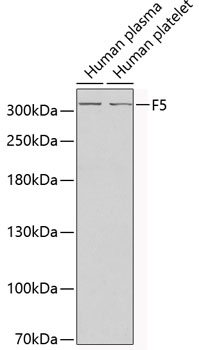 Western blot - F5 Polyclonal Antibody 