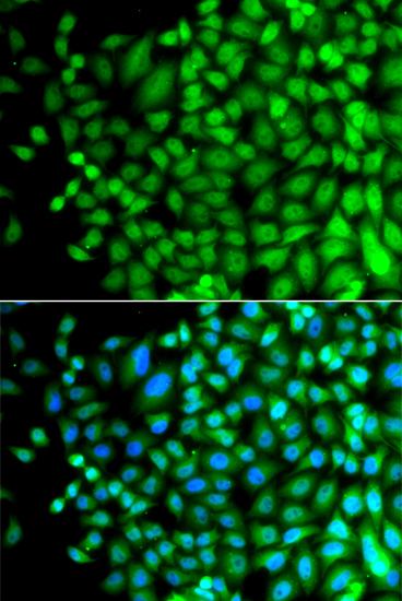 Immunofluorescence - SUPT20H Polyclonal Antibody 