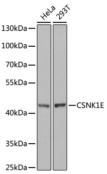 Western blot - CSNK1E Polyclonal Antibody 