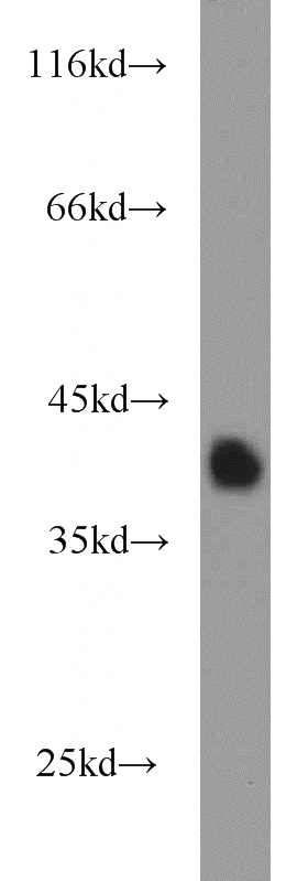 human colon tissue were subjected to SDS PAGE followed by western blot with Catalog No:114281(PRSS8 antibody) at dilution of 1:500