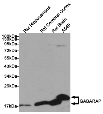 Western blot detection of GABARAP in Rat Hippocampus, Rat Cerebral Cortex, Rat Brain and A549 cell lysates using GABARAP Rabbit pAb (1:1000 diluted). Predicted band size: 14KDa. Observed band size:14, 16KDa.