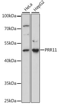Western blot - PRR11 Polyclonal Antibody 