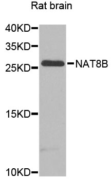 Western blot - NAT8B Polyclonal Antibody 