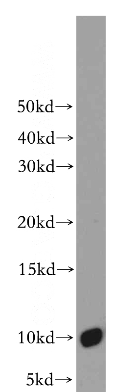 mouse skin tissue were subjected to SDS PAGE followed by western blot with Catalog No:108604(C16orf14 antibody) at dilution of 1:2000