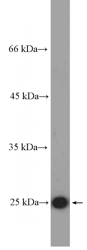 Serum from mouse injected with bacteria were subjected to SDS PAGE followed by western blot with Catalog No:109578(CRP Antibody) at dilution of 1:600