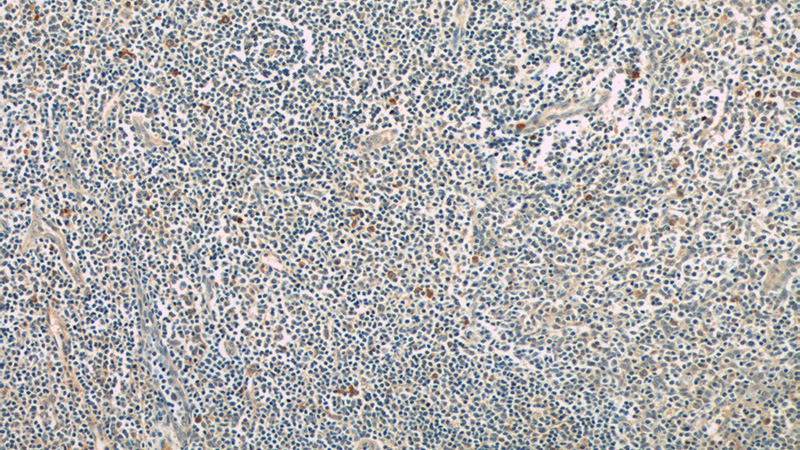 Immunohistochemistry of paraffin-embedded human tonsillitis tissue slide using Catalog No:112063(KIR3DX1 Antibody) at dilution of 1:50 (under 10x lens)