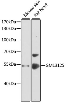 Western blot - GM13125 Polyclonal Antibody 