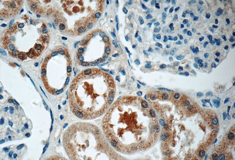 Immunohistochemistry of paraffin-embedded human kidney tissue slide using Catalog No:111563(HSN2 Antibody) at dilution of 1:50 (under 40x lens)