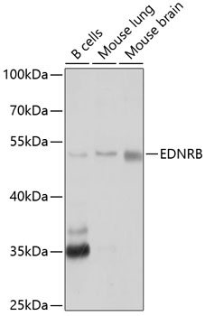 Western blot - EDNRB Polyclonal Antibody 