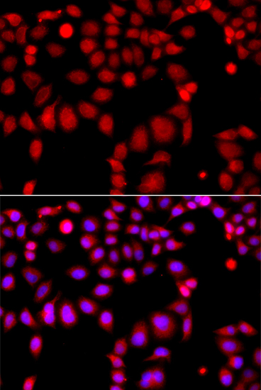 Immunofluorescence - ARHGEF9 Polyclonal Antibody 