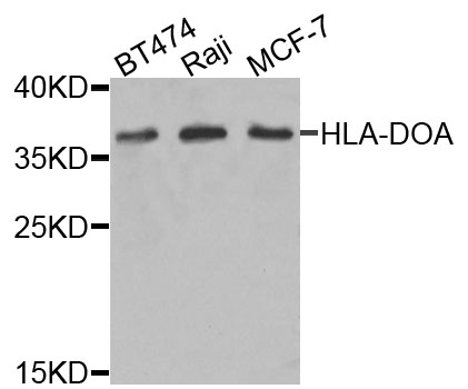 Western blot - HLA-DOA Polyclonal Antibody 