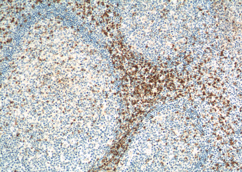 Immunohistochemistry of paraffin-embedded human tonsillitis tissue slide using Catalog No:116350(TRAT1 Antibody) at dilution of 1:100 (under 10x lens). heat mediated antigen retrieved with Tris-EDTA buffer(pH9).