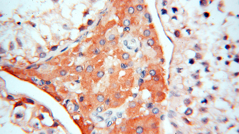 Immunohistochemical of paraffin-embedded human testis using Catalog No:115762(SYMPK antibody) at dilution of 1:50 (under 40x lens)