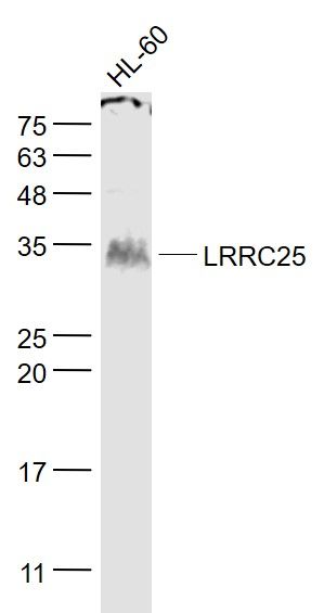 Fig1: Sample:; HL-60(Human) Cell Lysate at 30 ug; Primary: Anti- LRRC25 at 1/1000 dilution; Secondary: IRDye800CW Goat Anti-Rabbit IgG at 1/20000 dilution; Predicted band size: 31 kD; Observed band size: 31 kD