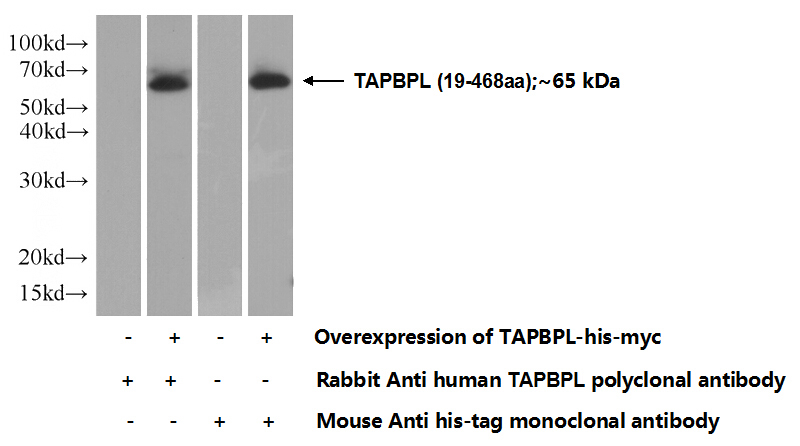 Transfected HEK-293 cells were subjected to SDS PAGE followed by western blot with Catalog No:115851(TAPBPL Antibody) at dilution of 1:500