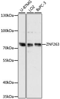 Western blot - ZNF263 Polyclonal Antibody 