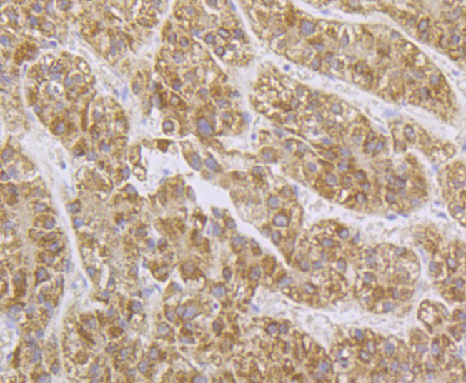 Fig2:; Immunohistochemical analysis of paraffin-embedded human liver tissue using anti-SPATA5L1 antibody. The section was pre-treated using heat mediated antigen retrieval with Tris-EDTA buffer (pH 8.0-8.4) for 20 minutes.The tissues were blocked in 5% BSA for 30 minutes at room temperature, washed with ddH; 2; O and PBS, and then probed with the primary antibody ( 1/100) for 30 minutes at room temperature. The detection was performed using an HRP conjugated compact polymer system. DAB was used as the chromogen. Tissues were counterstained with hematoxylin and mounted with DPX.