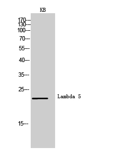 Fig1:; Western Blot analysis of KB cells using Lambda 5 Polyclonal Antibody.. Secondary antibody（catalog#：HA1001) was diluted at 1:20000