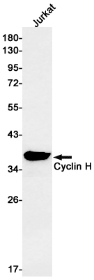 Western blot detection of Cyclin H in Jurkat cell lysates using Cyclin H Rabbit mAb(1:1000 diluted).Predicted band size:38kDa.Observed band size:36kDa.