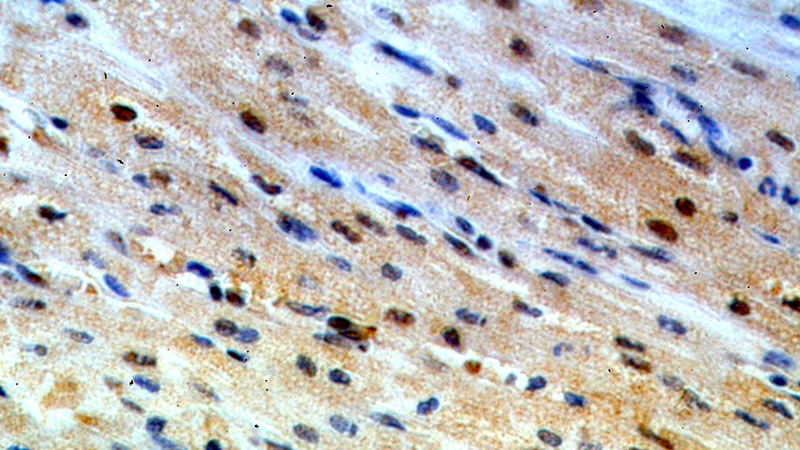 Immunohistochemical of paraffin-embedded human heart using Catalog No:116428(TSG101 antibody) at dilution of 1:50 (under 40x lens)