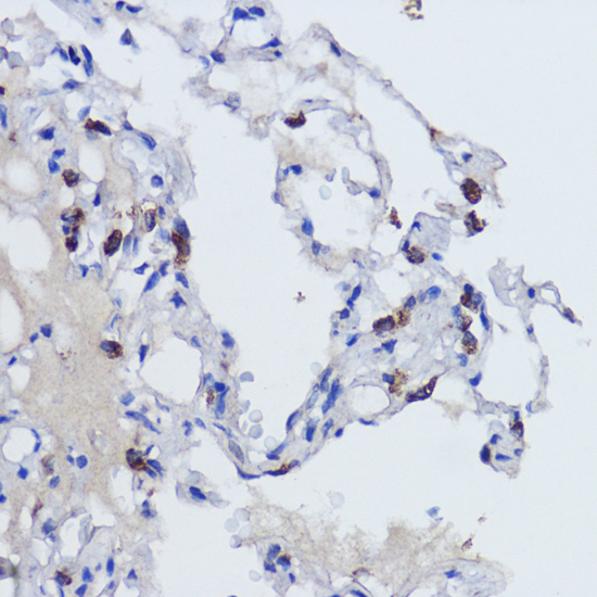 Immunohistochemistry - SFTPC Polyclonal Antibody 