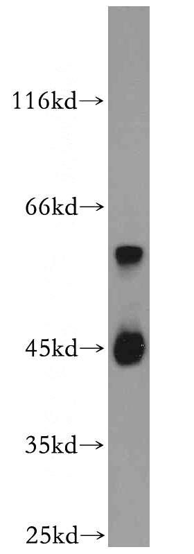 PC-3 cells were subjected to SDS PAGE followed by western blot with Catalog No:108393(B4GALT2 antibody) at dilution of 1:1000