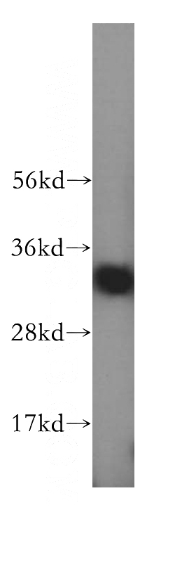 Jurkat cells were subjected to SDS PAGE followed by western blot with Catalog No:110975(GIMAP7 antibody) at dilution of 1:800