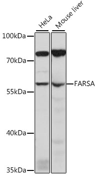 Western blot - FARSA Polyclonal Antibody 