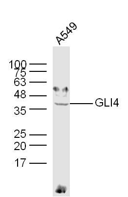 Fig1: Sample:; A549 Cell (Human) Lysate at 30 ug; Primary: Anti-GLI4 at 1/300 dilution; Secondary: IRDye800CW Goat Anti-Rabbit IgG at 1/20000 dilution; Predicted band size: 41 kD; Observed band size: 41 kD