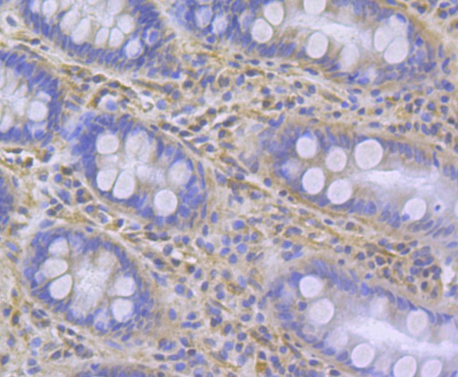 Fig6: Immunohistochemical analysis of paraffin-embedded human colon tissue using anti-ITPR2 antibody. Counter stained with hematoxylin.