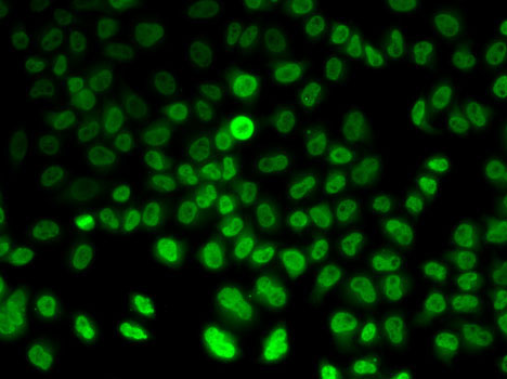 Immunofluorescence - ASMT Polyclonal Antibody 