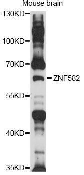 Western blot - ZNF582 Polyclonal Antibody 