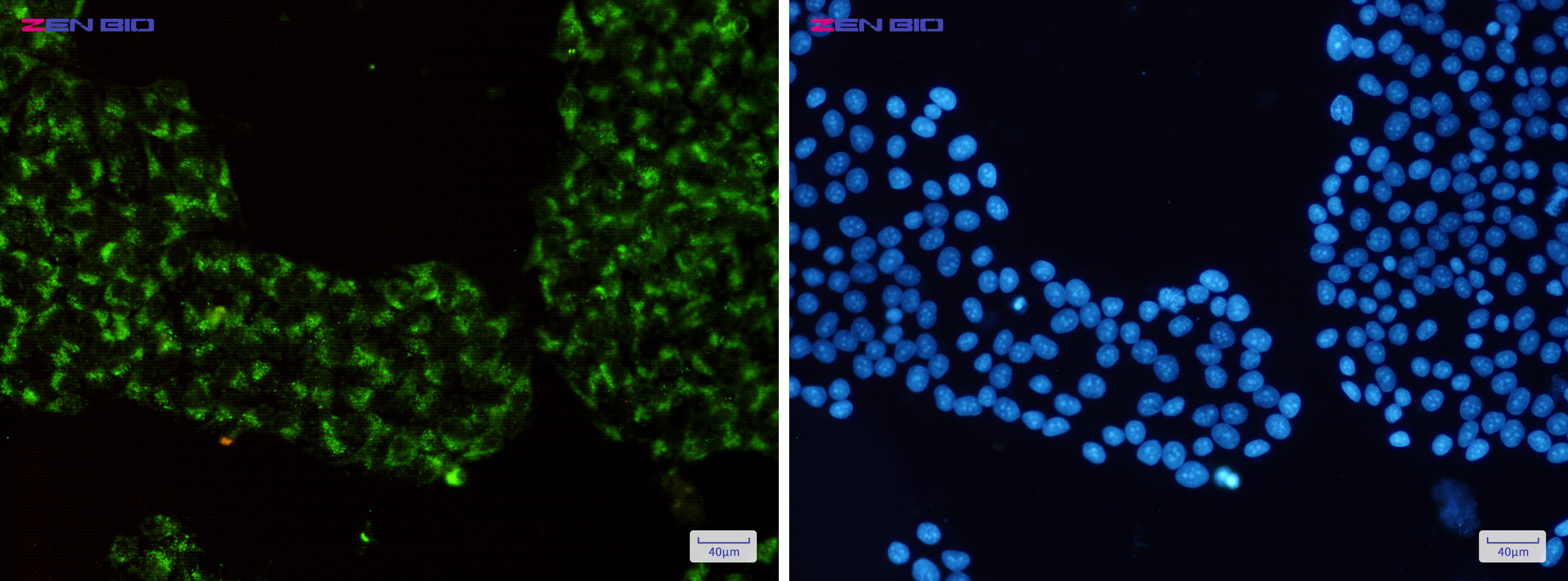 Immunocytochemistry of RAB7(green) in Hela cells using RAB7 Rabbit pAb at dilution 1/50, and DAPI(blue)
