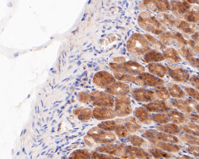 Fig3: Immunohistochemical analysis of paraffin-embedded rat stomach tissue using anti-Gasdermin D antibody. The section was pre-treated using heat mediated antigen retrieval with sodium citrate buffer (pH 6.0) for 20 minutes. The tissues were blocked in 5% BSA for 30 minutes at room temperature, washed with ddH2O and PBS, and then probed with the primary antibody ( 1/200) for 30 minutes at room temperature. The detection was performed using an HRP conjugated compact polymer system. DAB was used as the chromogen. Tissues were counterstained with hematoxylin and mounted with DPX.