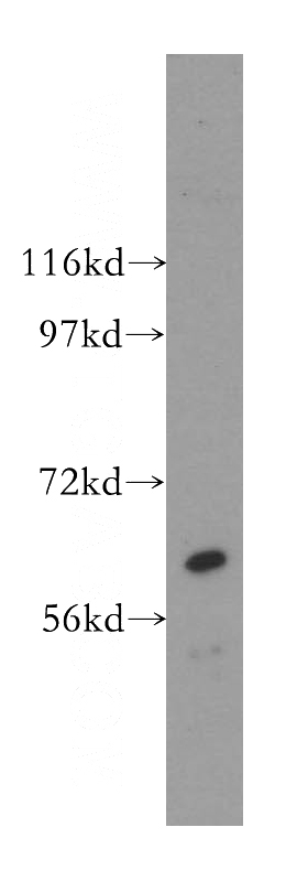 HEK-293 cells were subjected to SDS PAGE followed by western blot with Catalog No:114542(RANGAP1 antibody) at dilution of 1:1000