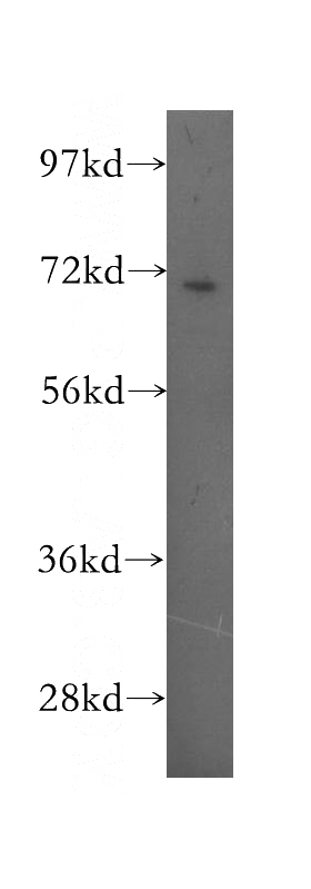 Y79 cells were subjected to SDS PAGE followed by western blot with Catalog No:114106(PPP2R5D antibody) at dilution of 1:400