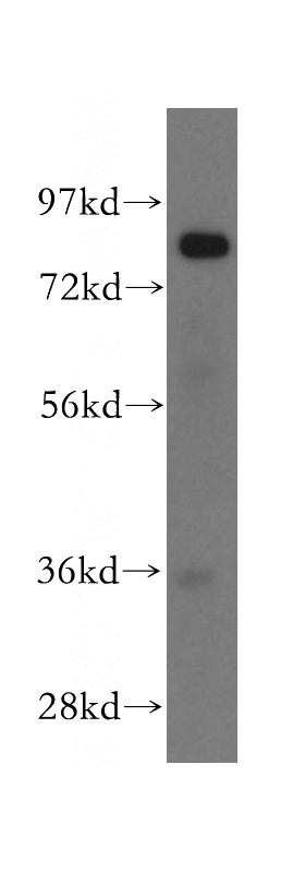 mouse liver tissue were subjected to SDS PAGE followed by western blot with Catalog No:111317(GUSB antibody) at dilution of 1:500