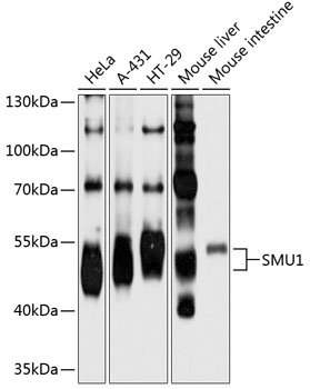 Western blot - SMU1 Polyclonal Antibody 