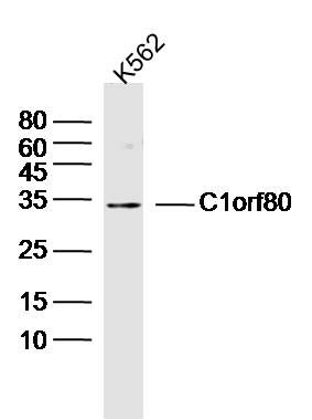 Fig1: Sample: K562 Cell (Human) Lysate at 40 ug; Primary: Anti-C1orf80 at 1/300 dilution; Secondary: IRDye800CW Goat Anti-Rabbit IgG at 1/20000 dilution; Predicted band size: 35 kD; Observed band size: 34 kD