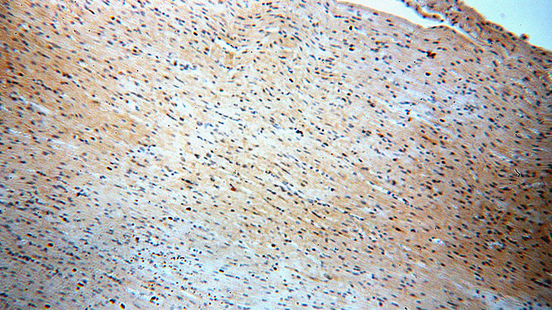 Immunohistochemical of paraffin-embedded human heart using Catalog No:115704(STEAP2-Specific antibody) at dilution of 1:100 (under 10x lens)