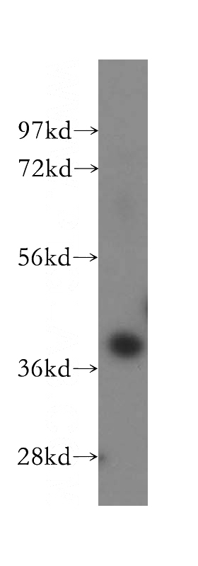 HEK-293 cells were subjected to SDS PAGE followed by western blot with Catalog No:111339(HP antibody) at dilution of 1:500