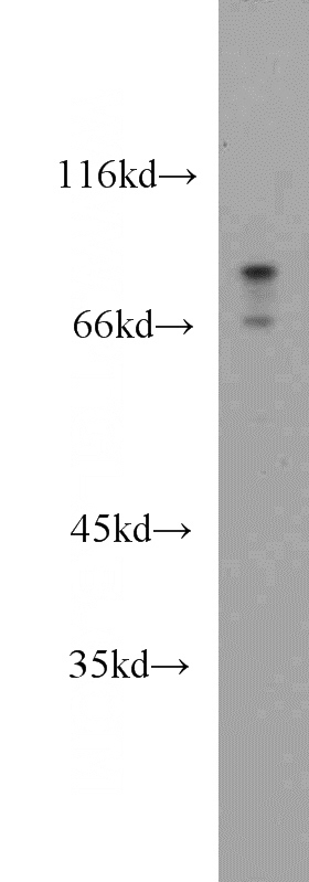 A375 cells were subjected to SDS PAGE followed by western blot with Catalog No:112651(MLPH antibody) at dilution of 1:1000