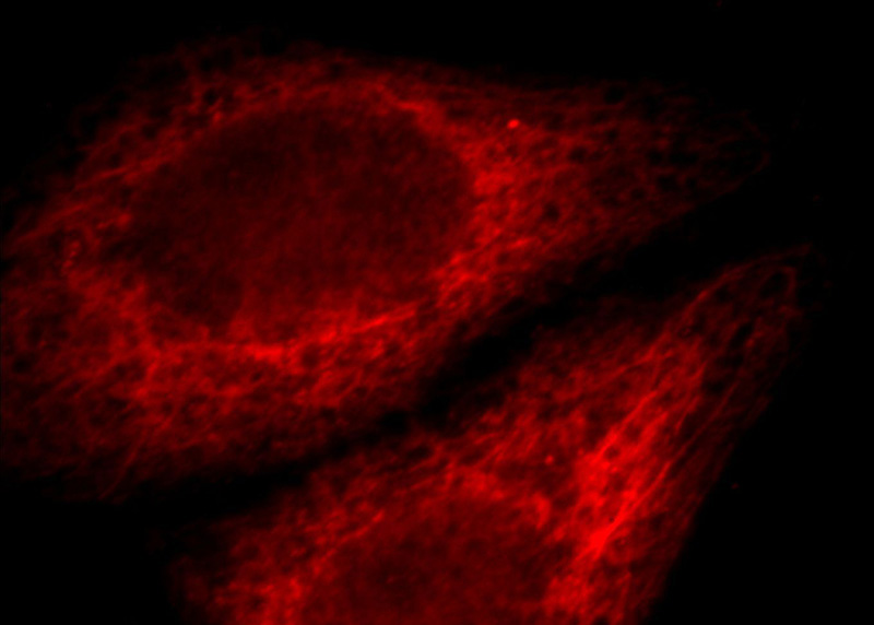Immunofluorescent analysis of HepG2 cells, using IL17RB antibody Catalog No:111765 at 1:25 dilution and Rhodamine-labeled goat anti-rabbit IgG (red).