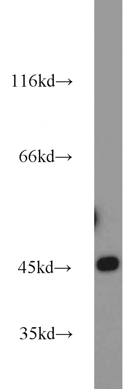 HEK-293 cells were subjected to SDS PAGE followed by western blot with Catalog No:111603(IDH2 antibody) at dilution of 1:1000