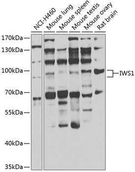 Western blot - IWS1 Polyclonal Antibody 